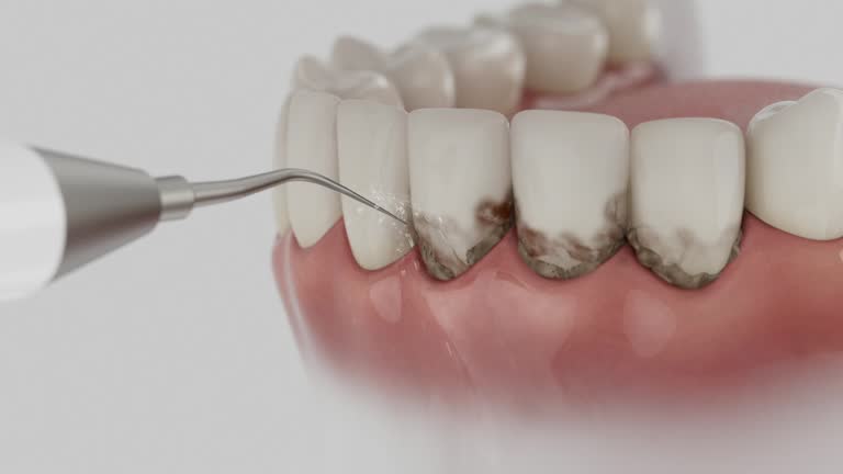 Trusted Emergency Dentist service in Madeira, OH - Dentist Open Now